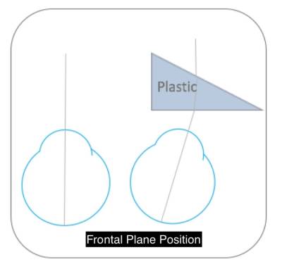frontal plane position frontal plane position